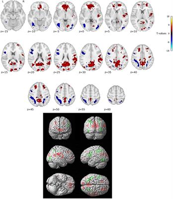 Functional neuroanatomy of reading in Czech: Evidence of a dual-route processing architecture in a shallow orthography